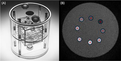 Synthetic MRI for Radiotherapy Planning for Brain and Prostate Cancers: Phantom Validation and Patient Evaluation